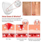 DermaSmooth Skin Tag Remover Patch