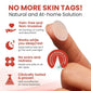 DermaSmooth Skin Tag Remover Patch